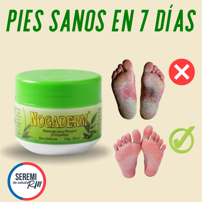 Pies Sanos❤️, Crema Nogaderm antifúngica +❤️Guía digital de Bienestar de regalo