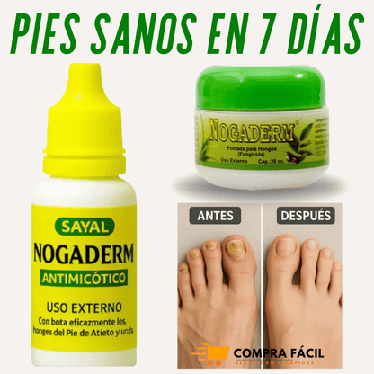Pies Sanos❤️ Gotas Nogaderm + Crema Nogaderm de regalo  +❤️Guía digital de Bienestar de regalo