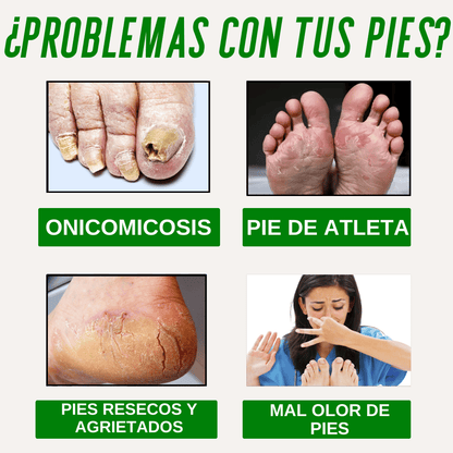 Pies Sanos❤️ Gotas Nogaderm + Crema Nogaderm de regalo  +❤️Guía digital de Bienestar de regalo