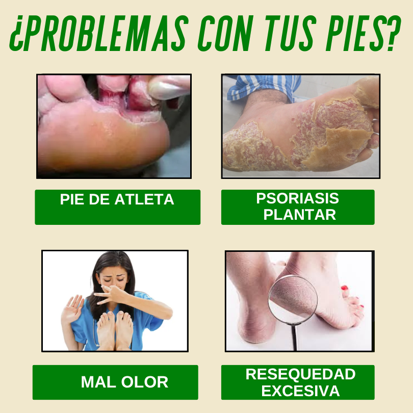 Pies Sanos❤️, Crema Nogaderm antifúngica +❤️Guía digital de Bienestar de regalo