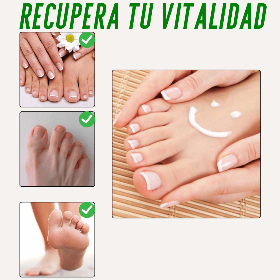 Pies Sanos❤️ Gotas Nogaderm + Crema Nogaderm de regalo  +❤️Guía digital de Bienestar de regalo