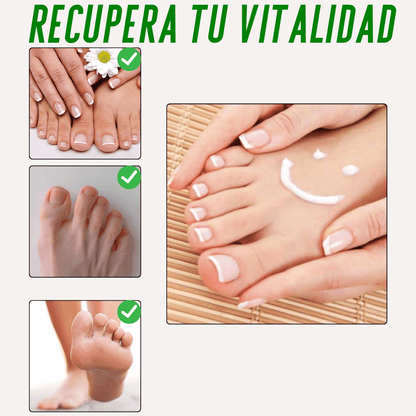Pies Sanos❤️ Gotas Nogaderm + Crema Nogaderm de regalo  +❤️Guía digital de Bienestar de regalo